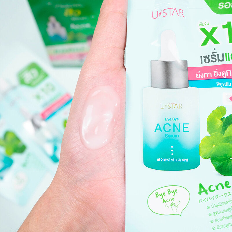 U-Star Bye Bye Acne Serum 8g