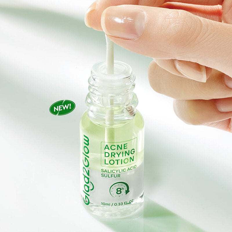 Glad2Glow Acne Drying Lotion - 10ml for Acne-Prone Skin
