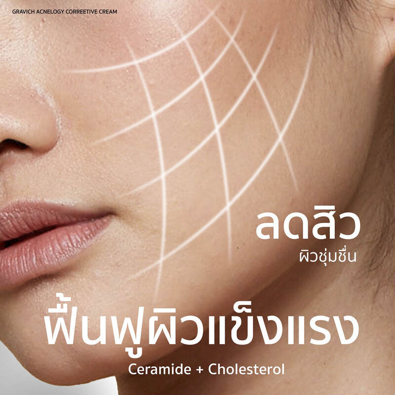 GRAVICH Acnelogy Corrective Cream 50g