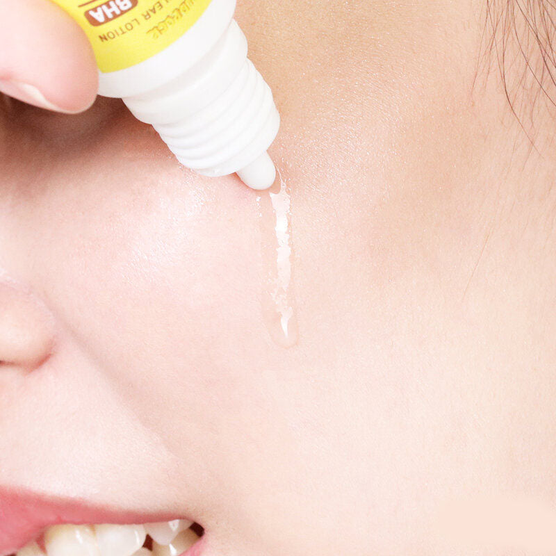OLD ROCK Anti-Acne Clear Lotion 10ml x 6pcs
